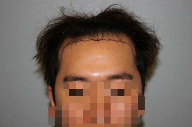 수술전2.jpg