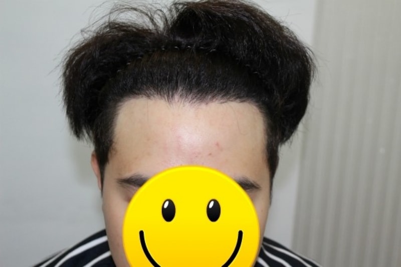 수술2.jpg