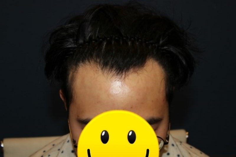 수술1.jpg