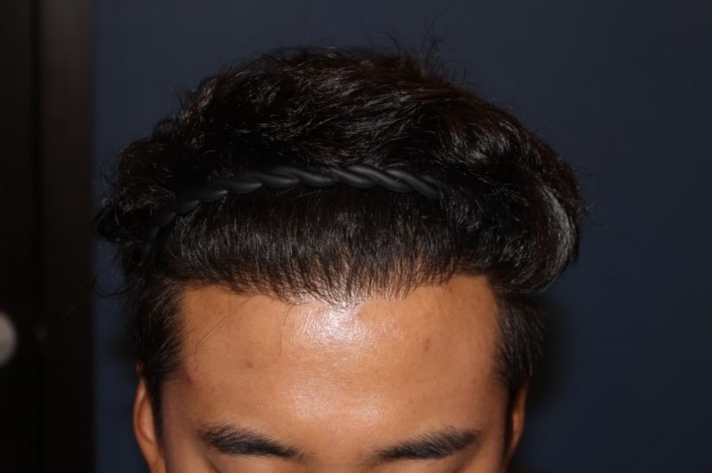수술후.jpg