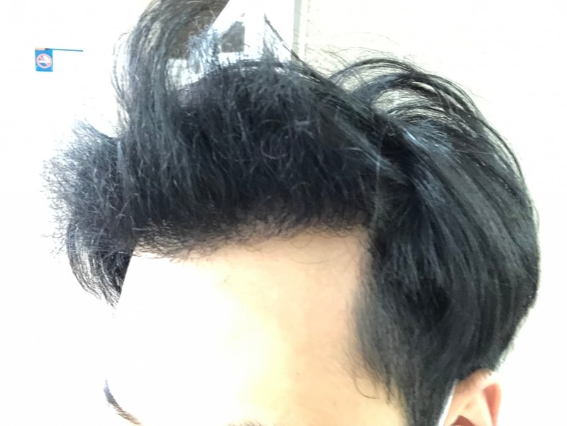 왼쪽2.jpg