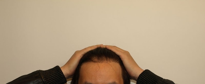 a정면후.jpg