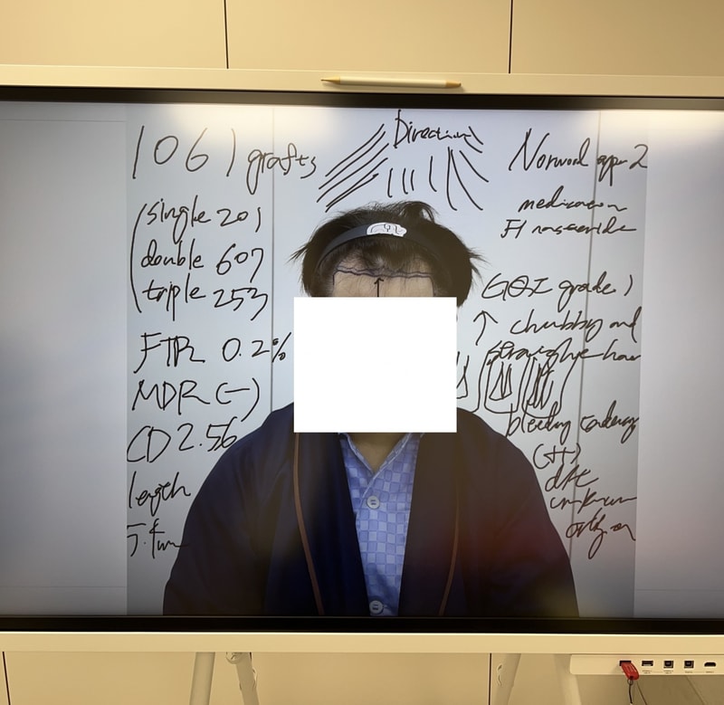 精神科医の手術翌日のレビュー - 狎鴎亭マンモス非切開