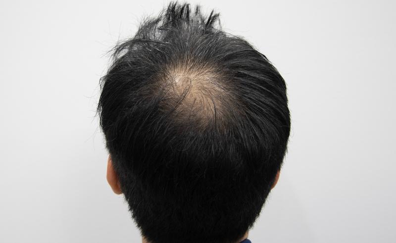 수술전.jpg