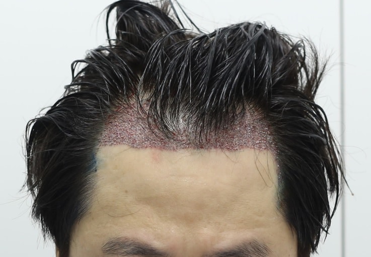 김 직후.jpg