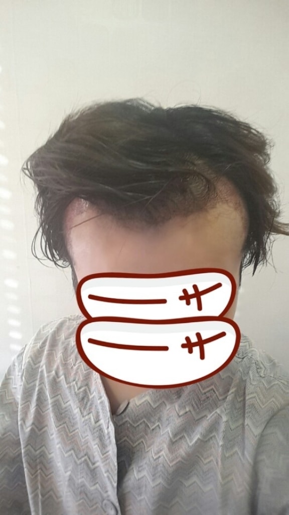 수술1.jpg