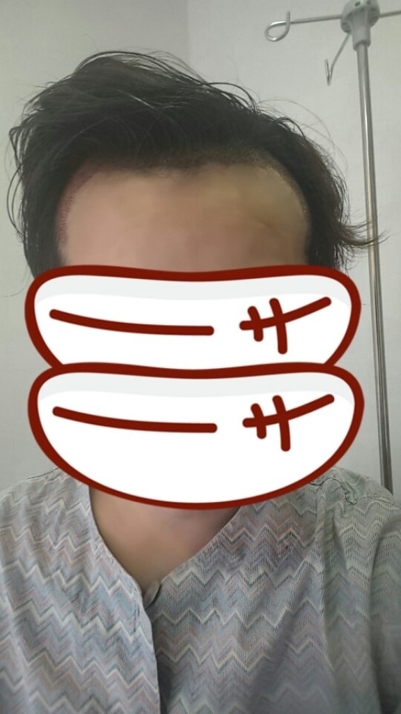 수술1-2.jpg