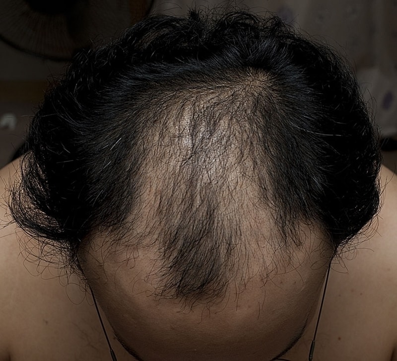 윗면.jpg