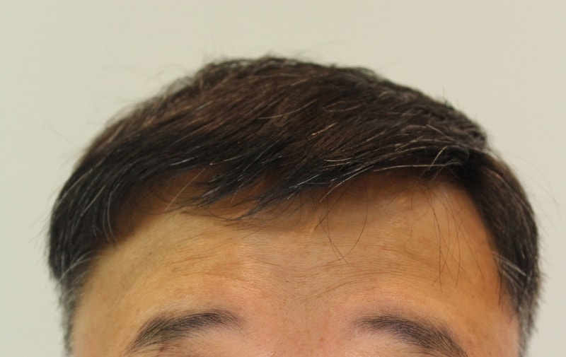 수술후7.jpg