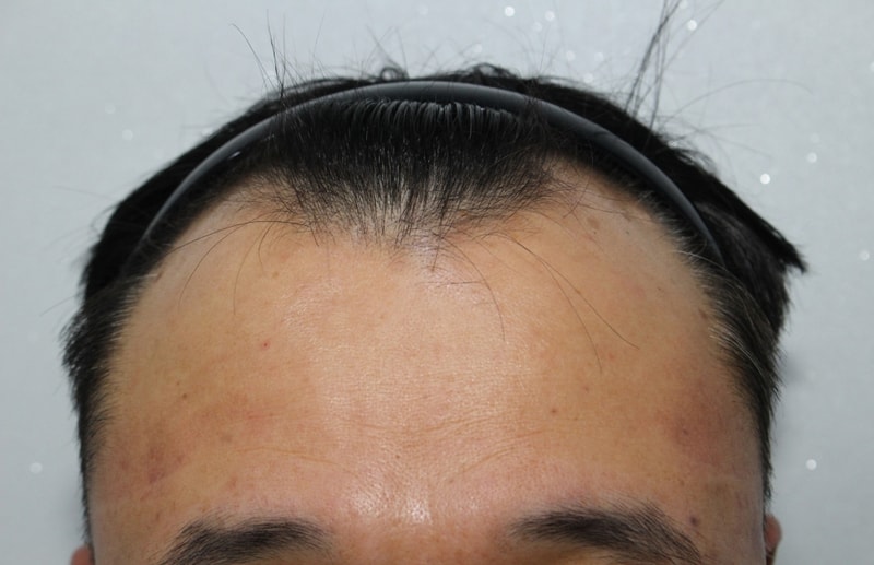 수술전2.jpg