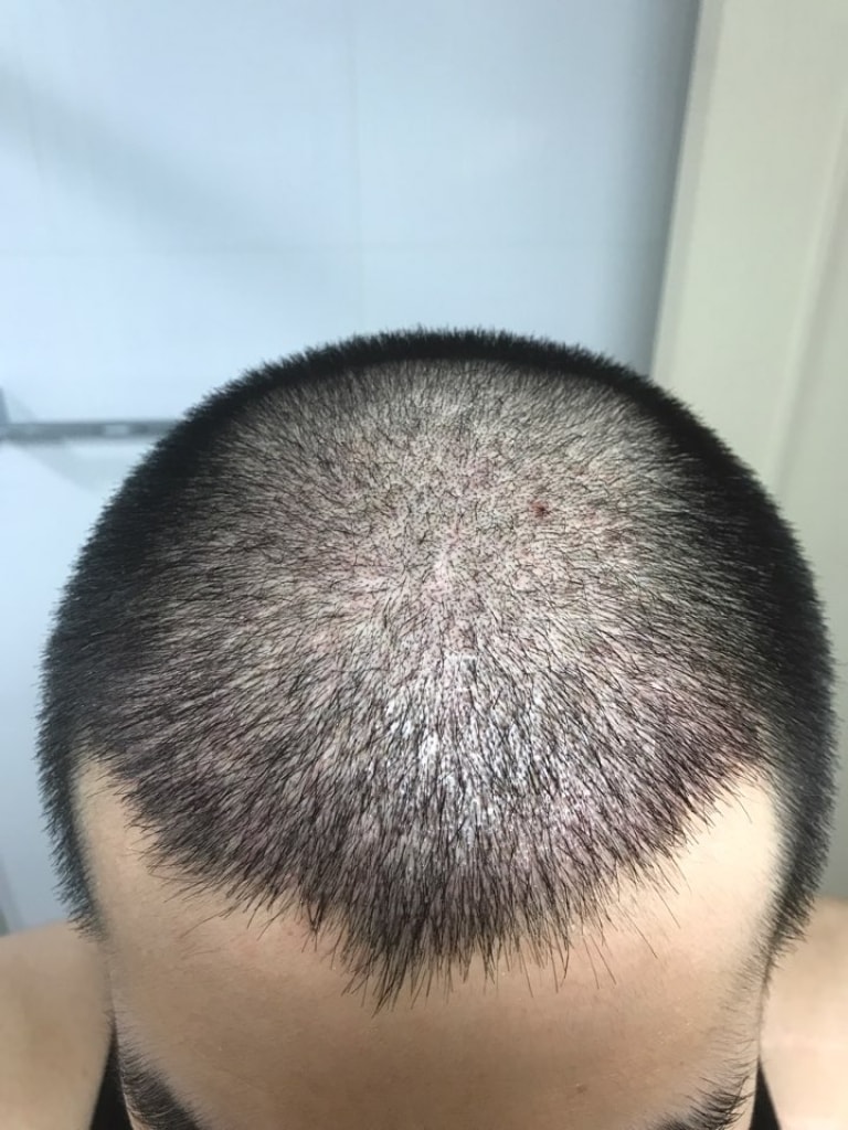 KakaoTalk_20170717_000155508.jpg