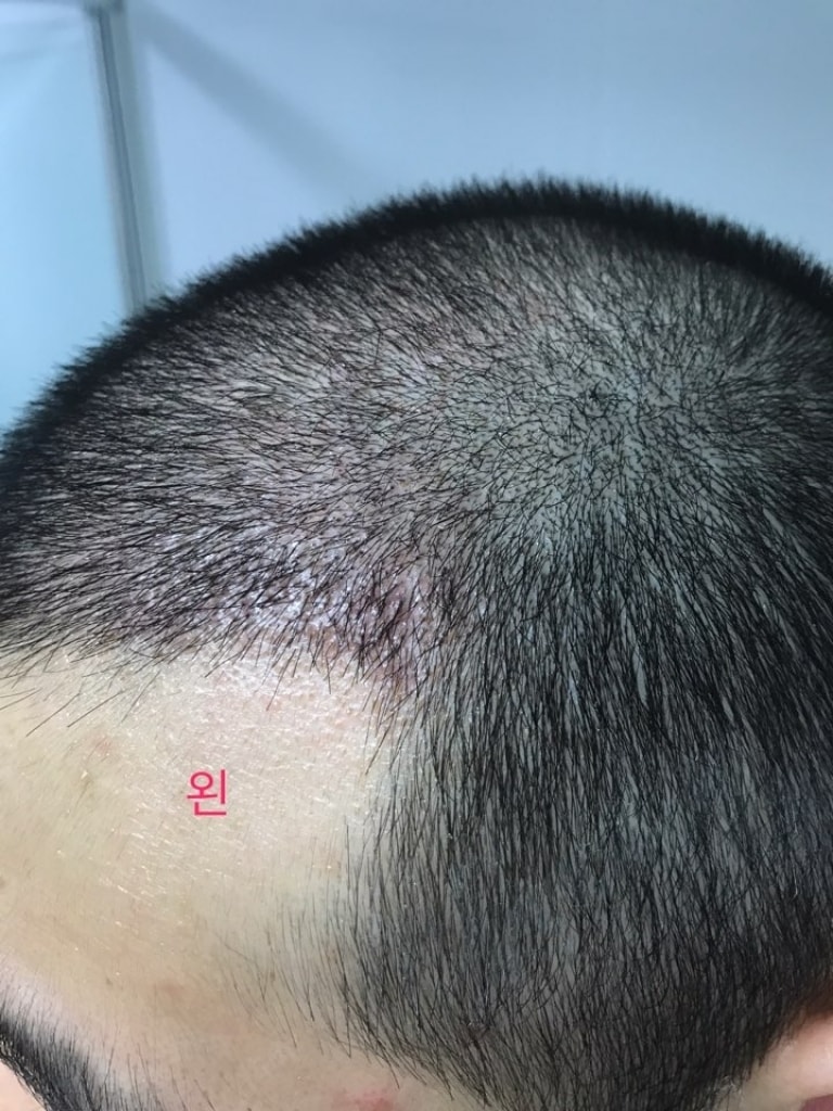 KakaoTalk_20170717_000154897.jpg
