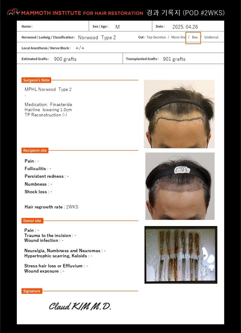 Busan Mammoth M-shape Slit Hair Transplantation 2 weeks later
