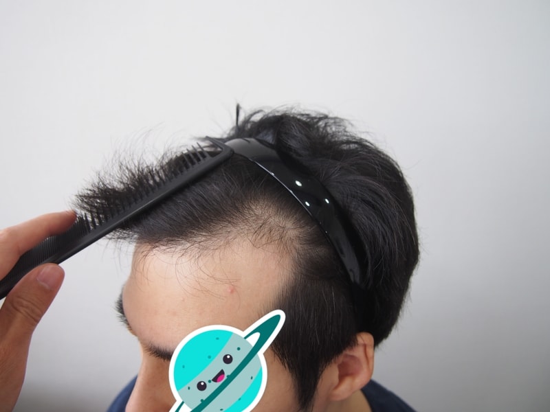 수술전.jpg