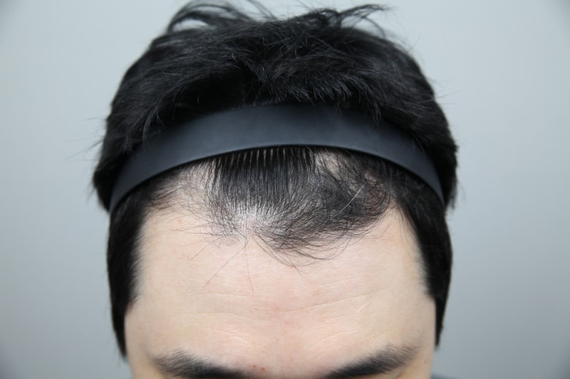 포토후기 이미지