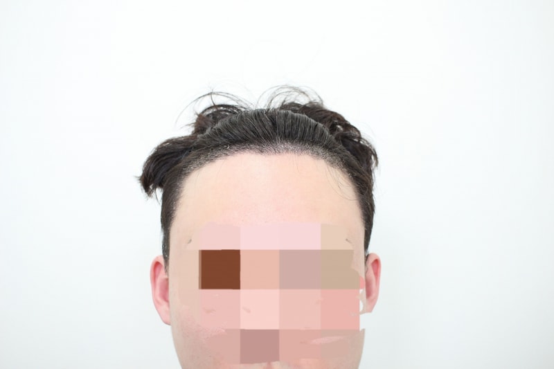 후 1.jpg
