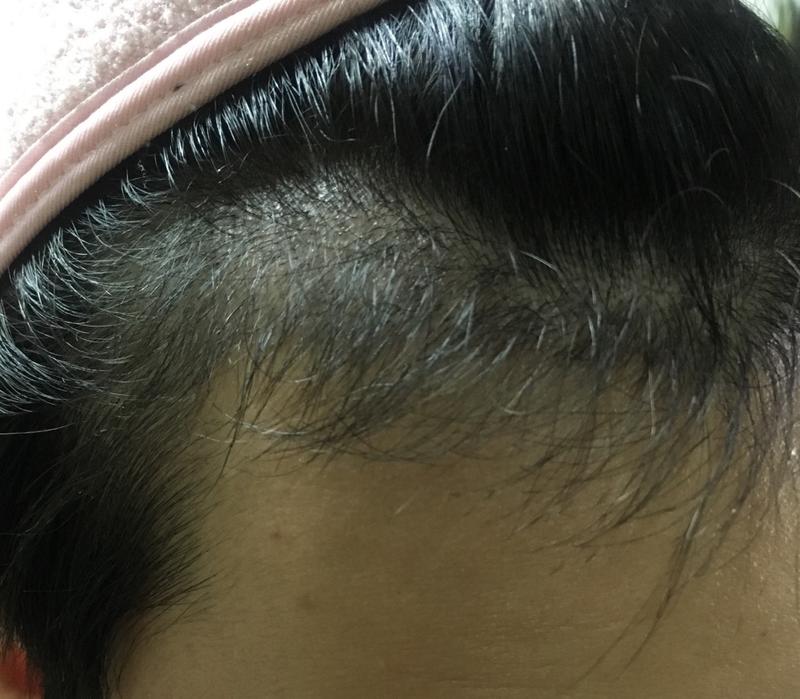8일뒤면 4개월차.....