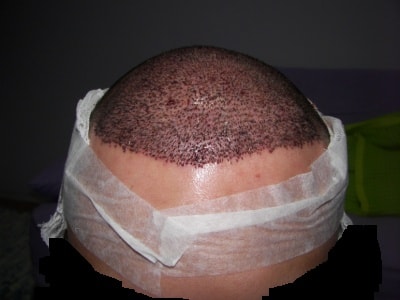 2차수술7.jpg