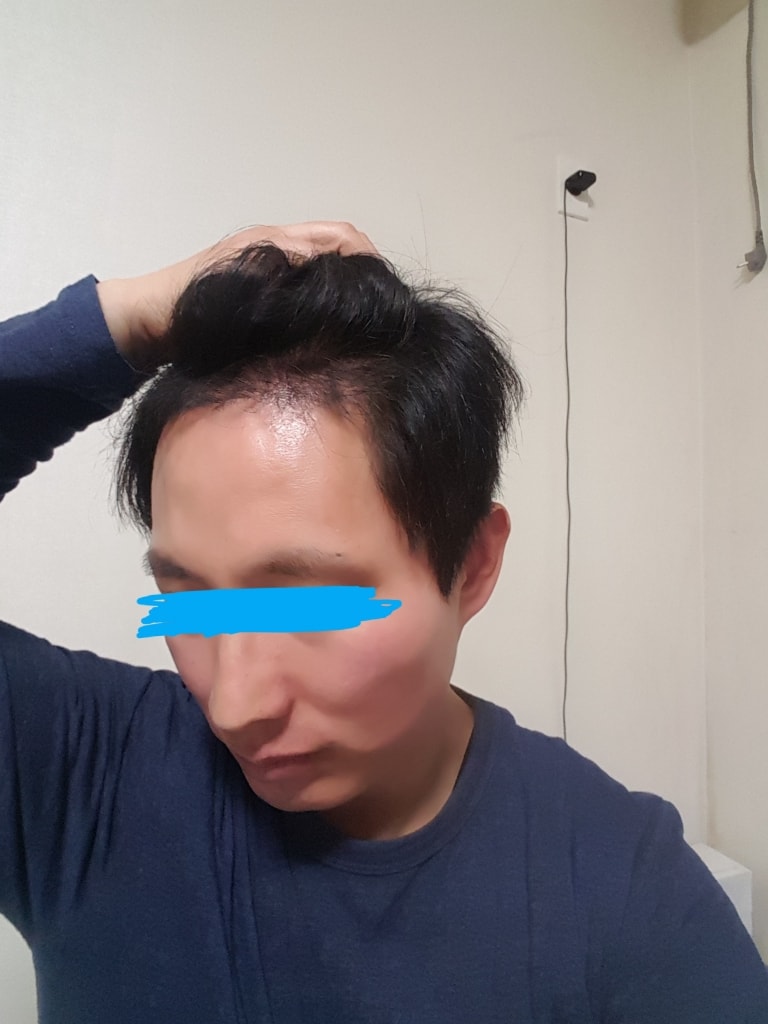 20180110_201346.jpg