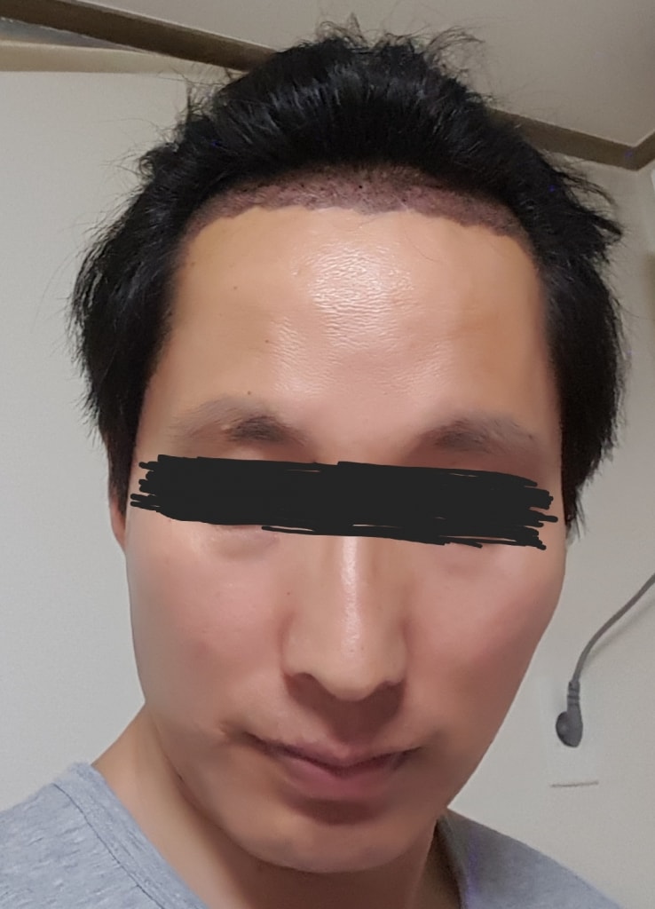 20170815_213519.jpg
