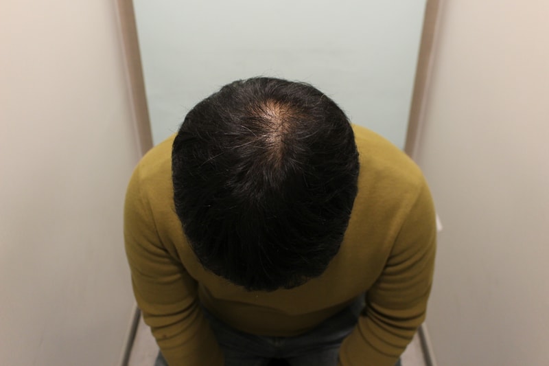 수술후 8개월 1.JPG