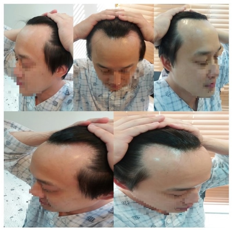 수술전.jpg