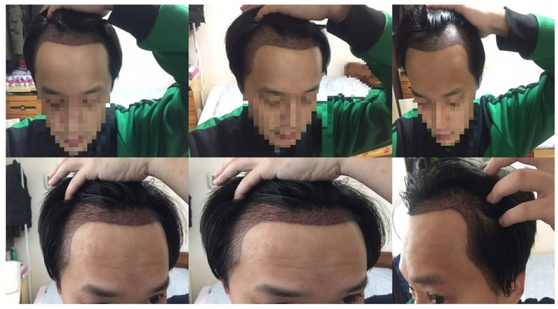 처음샴푸.jpg