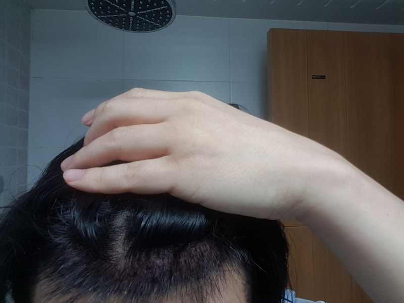 후앞.jpg