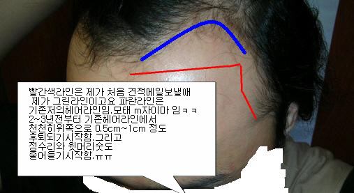 1-3보강설명.jpg