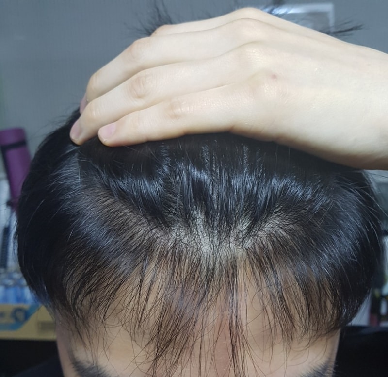 정면3.jpg