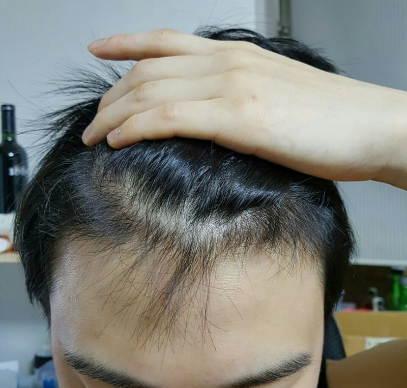 정면2.jpg