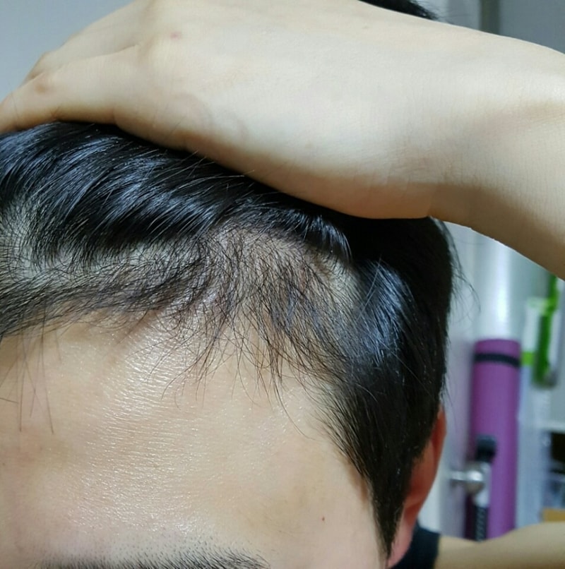 왼쪽2.jpg