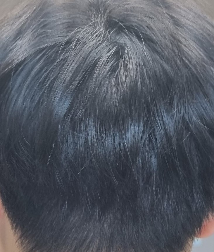 수술 후 2.jpg
