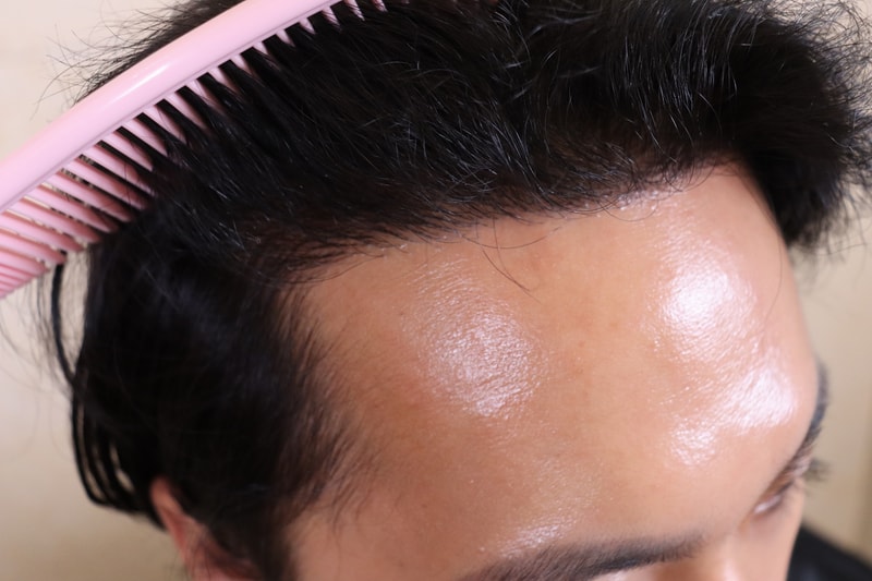 움찬의원 절개 8개월차