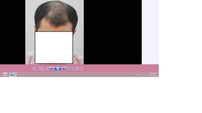 수술전11.png
