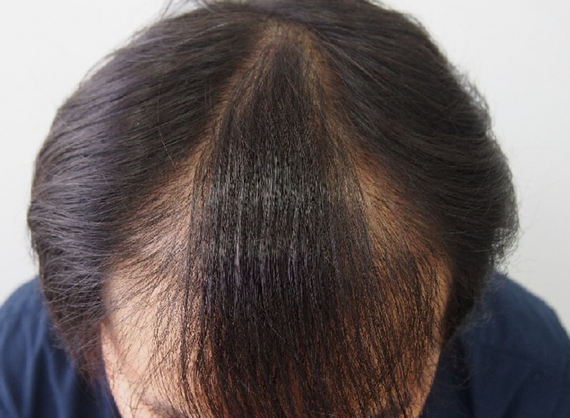 수술전1.jpg