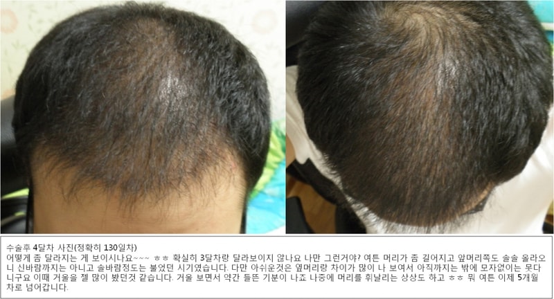 포맷변환_4개월.jpg