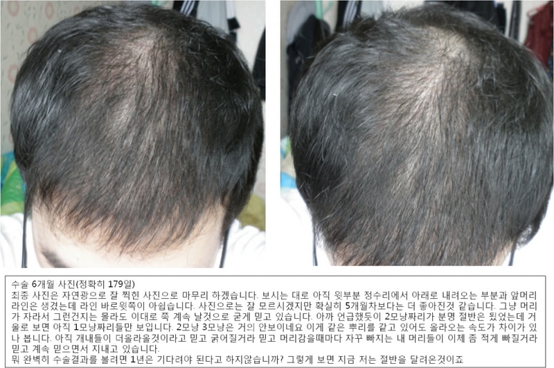 포맷변환_6개월.jpg