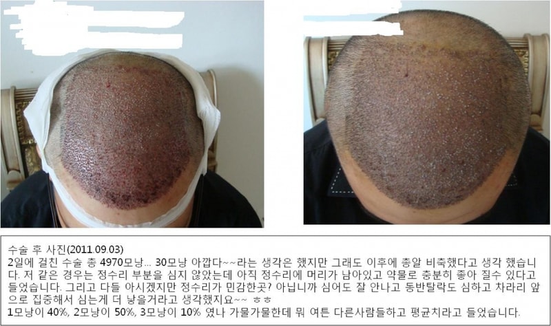 포맷변환_수술후.jpg