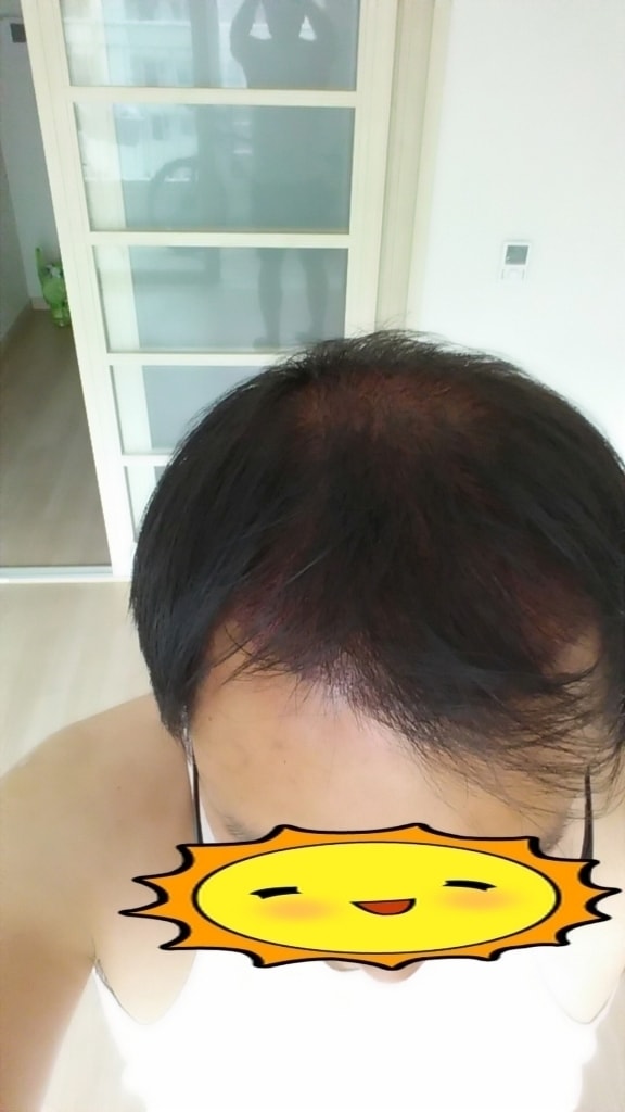 꾸미기_20150903_142536.jpg