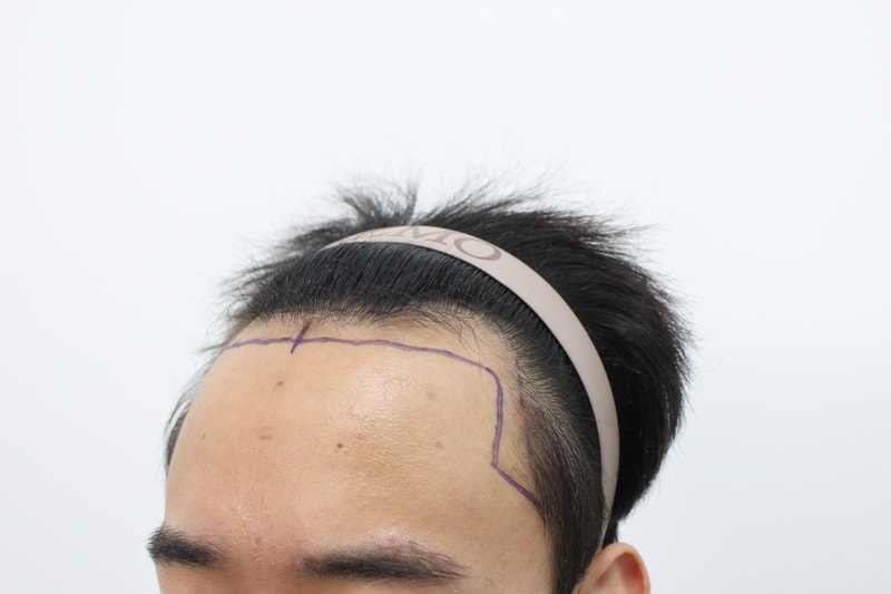 오른쪽전.jpg