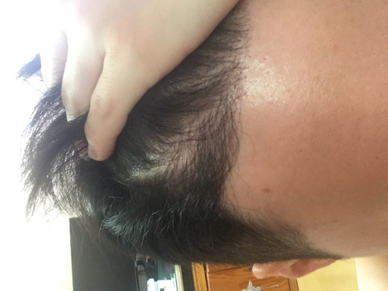 是第5个月的后期。