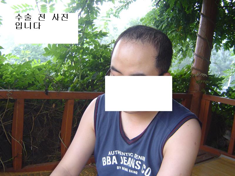 수술전.jpg
