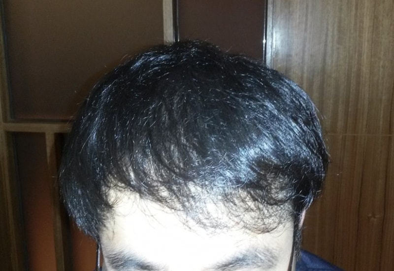 수술후.jpg