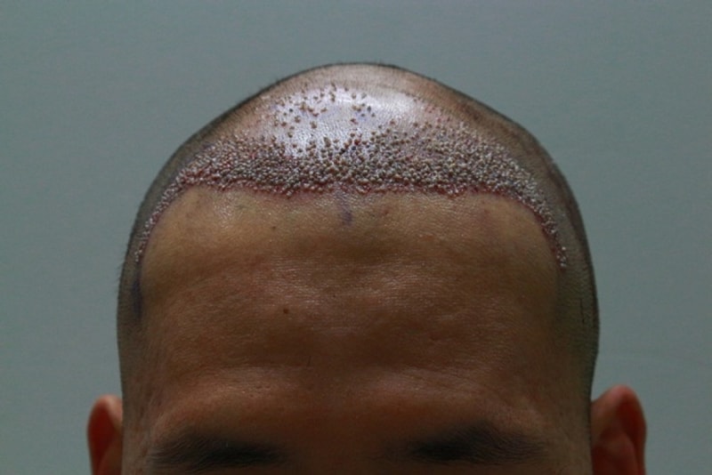 제 머리도 한번 봐주시면 감사하겠습니다
