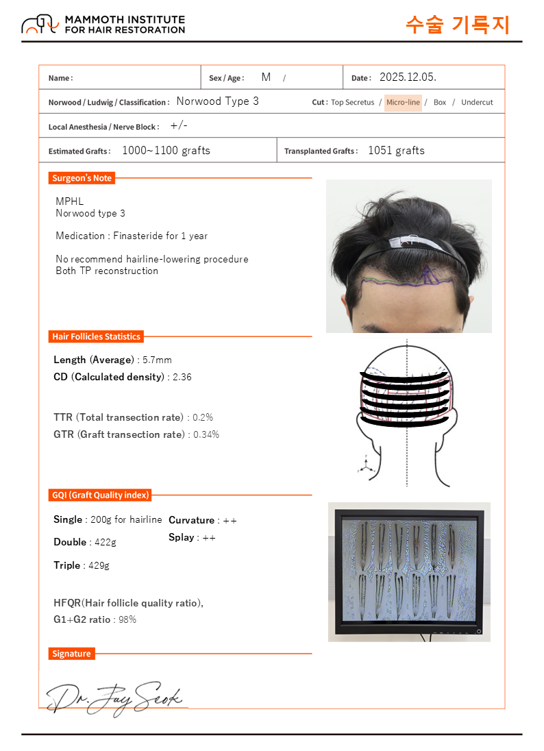 압구정 맘모스 비절개 모발이식 후기