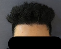 1년후_3.jpg