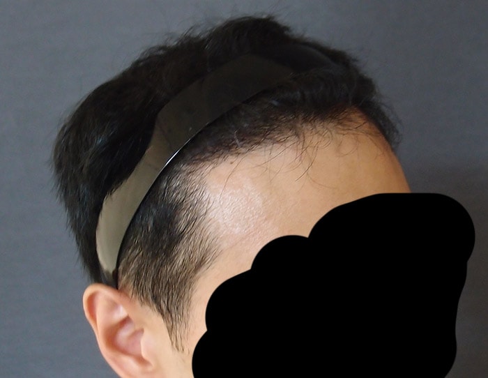 수술후1.jpg