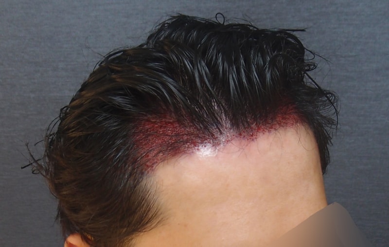 수술후02.jpg