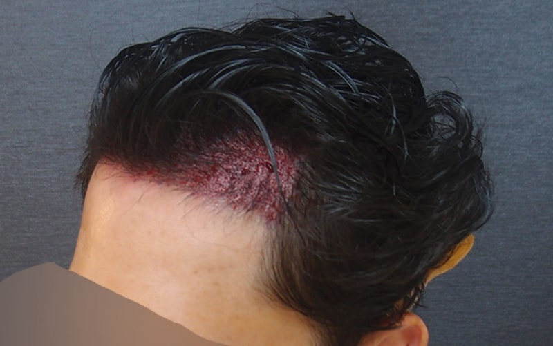수술후03.jpg